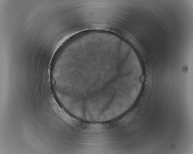 X0000113940932200911061238