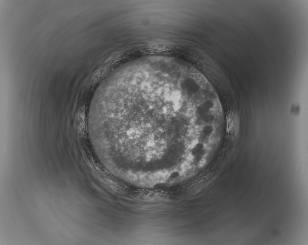 X0000113941011200911061236