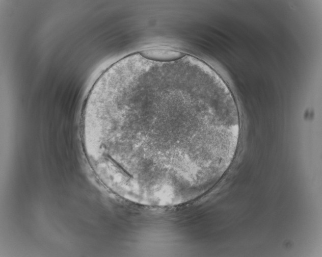 X0000113941104200911061235