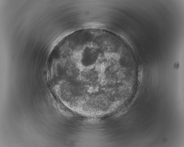 X0000113941117200911061235