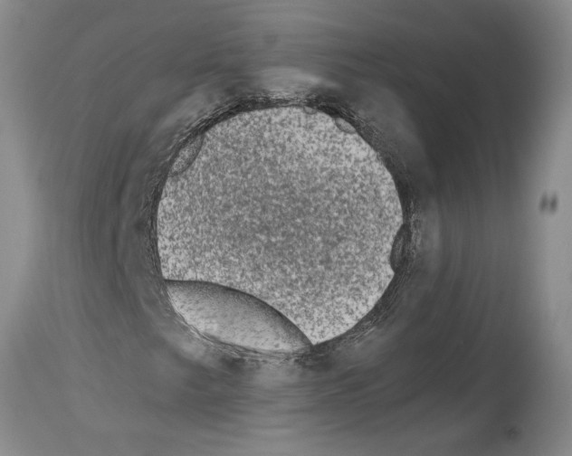 X0000113941249200911061233