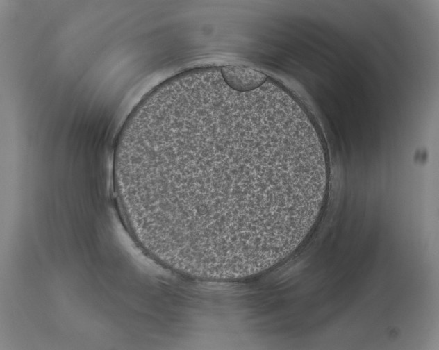 X0000113941295200911061233