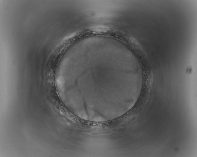 X0000113941445200911061230