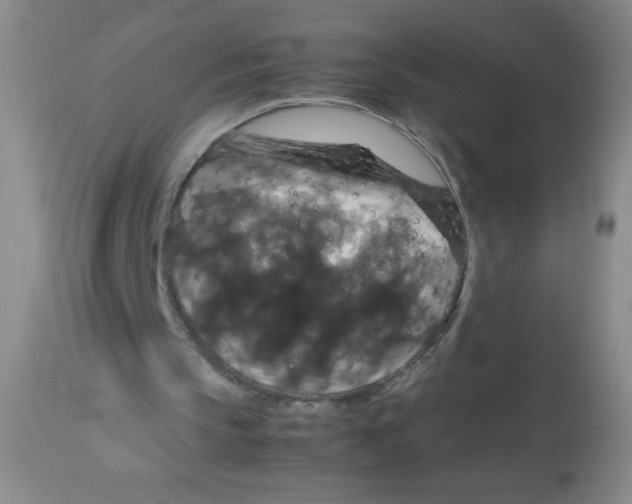 X0000113950145200910232014