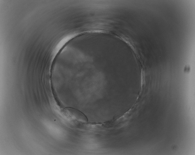 X0000113950147200910232014