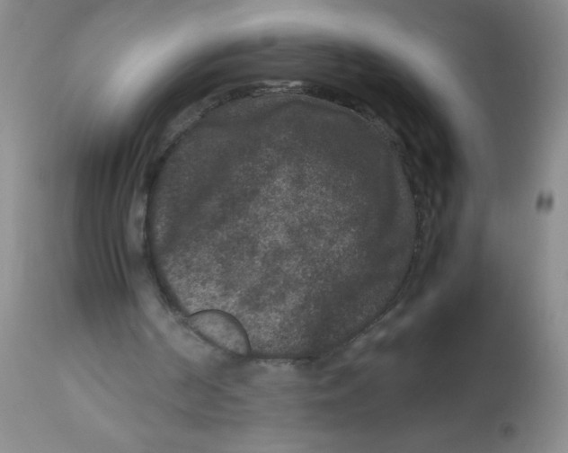 X0000113950194200910232014