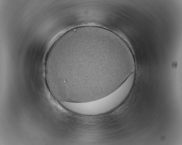 X0000113951096200911061258