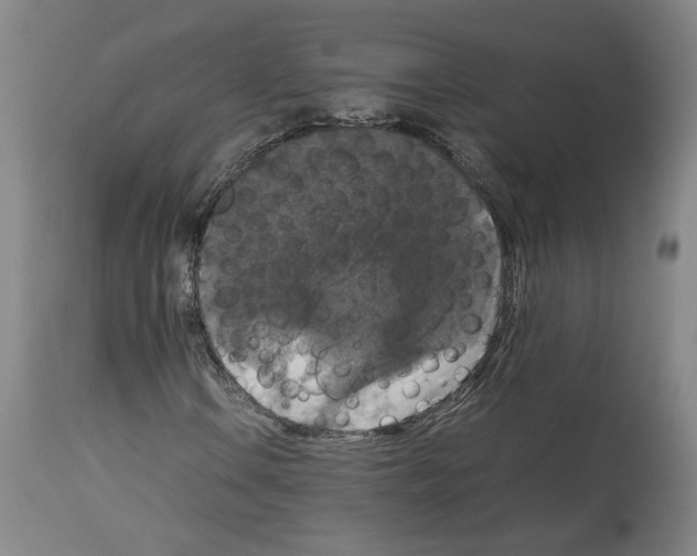 X0000113951106200911061257