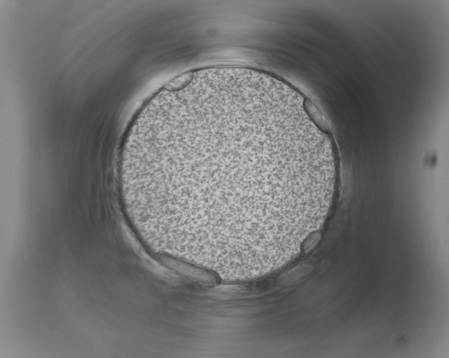 X0000113951477200911061252