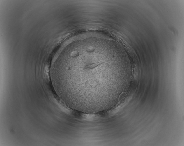 X0000113960575200909251403