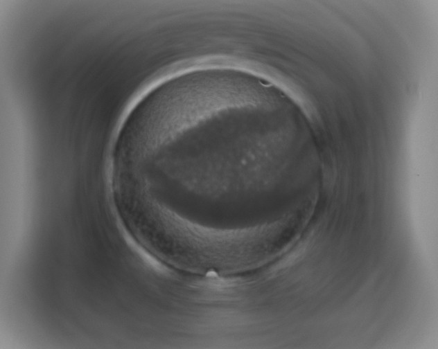 X0000113961527200910021515