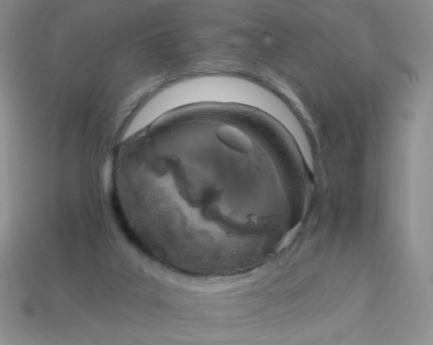 X0000113960019200910091638