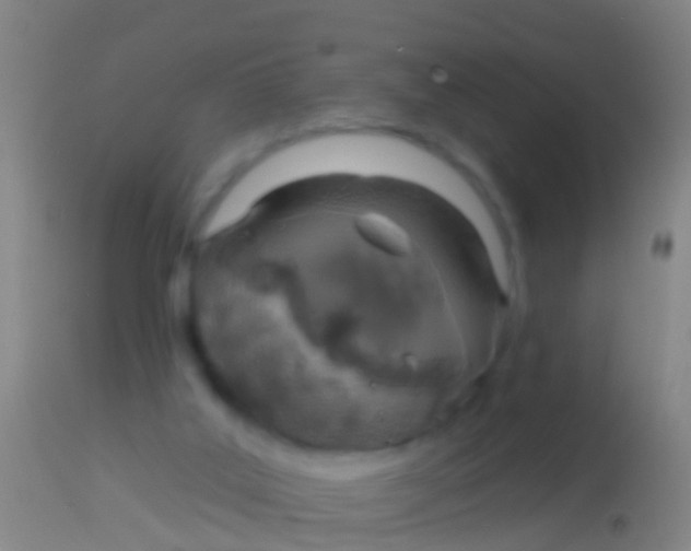 X0000113960019200910162014