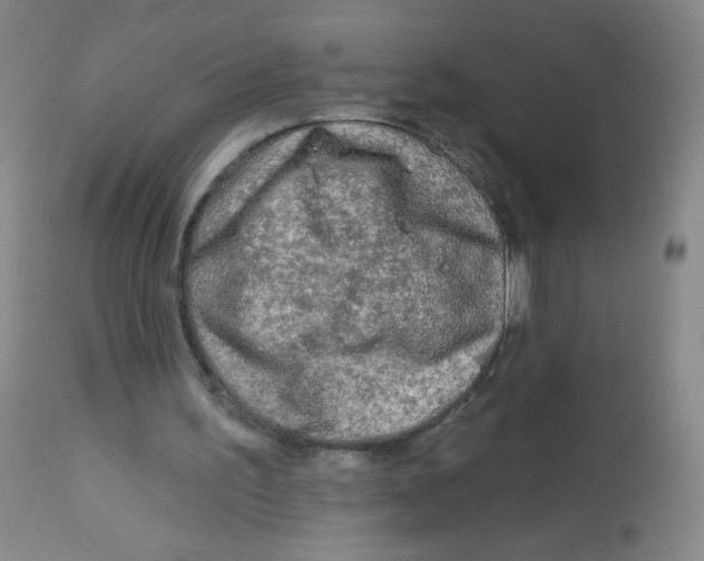 X0000113960195200910232036