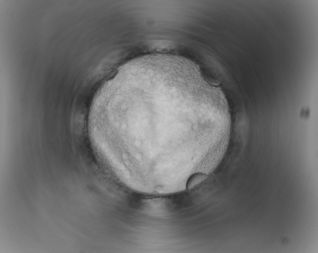 X0000113960417200910232033