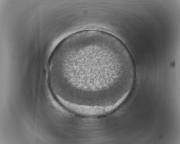 X0000113961515200910232017