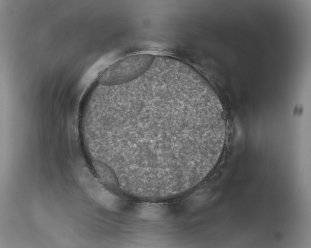 X0000113960296200911061331