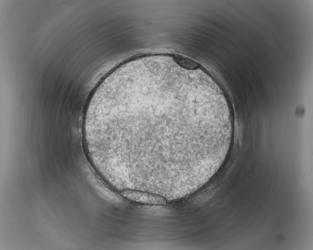 X0000113960389200911061330