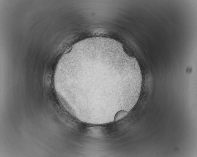 X0000113960417200911061330