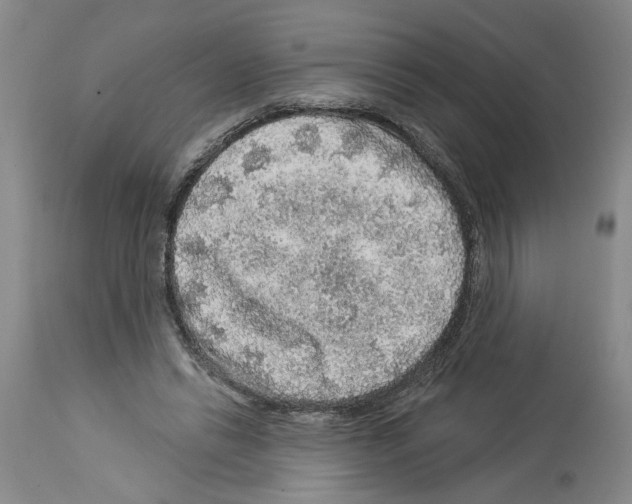 X0000113960446200911061329