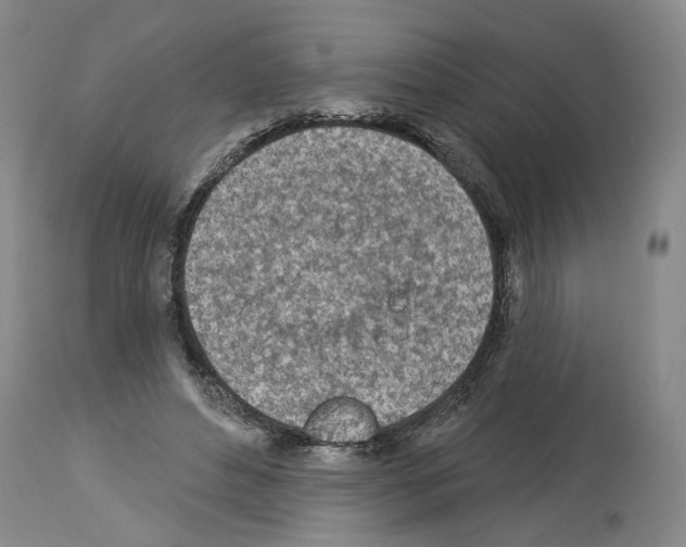 X0000113960496200911061329