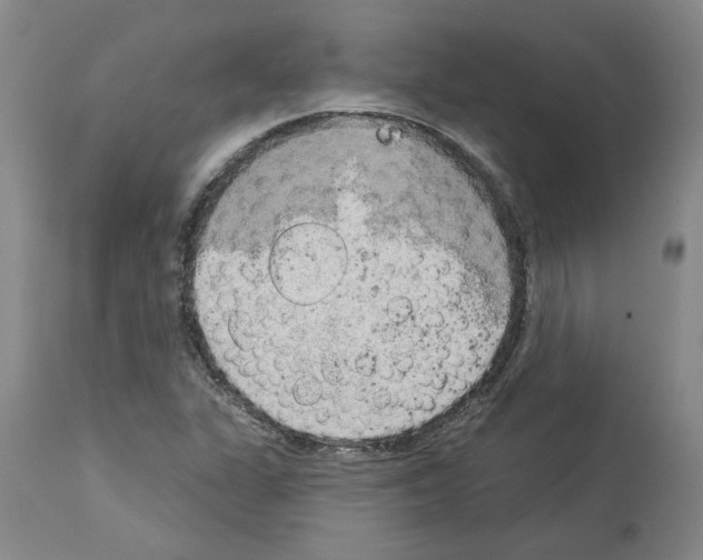 X0000113961311200911061317