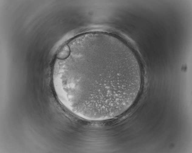 X0000113961411200911061315