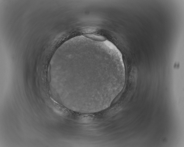 X0000113961441200911061315