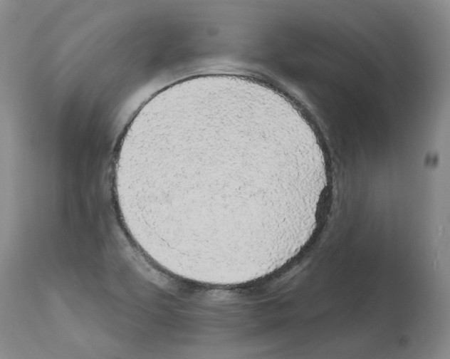 X0000113961463200911061315