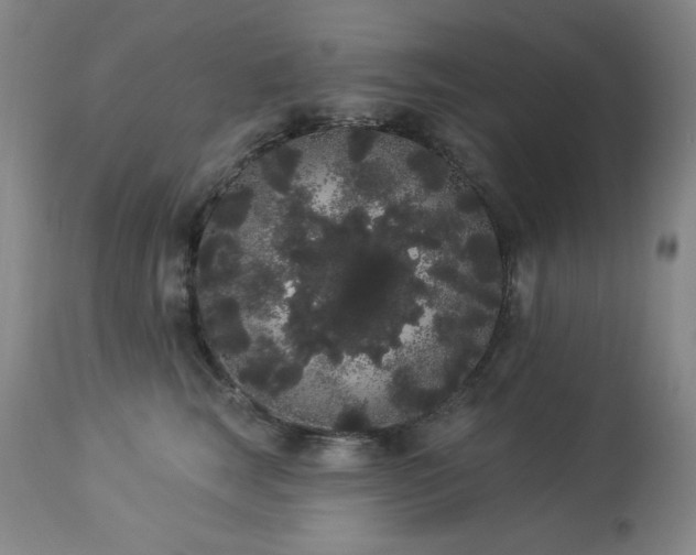 X0000113980663200910021138