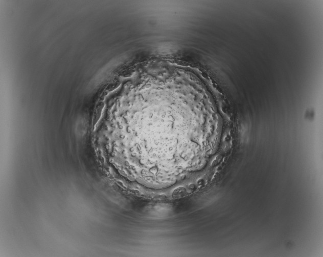 X0000113980665200910021138