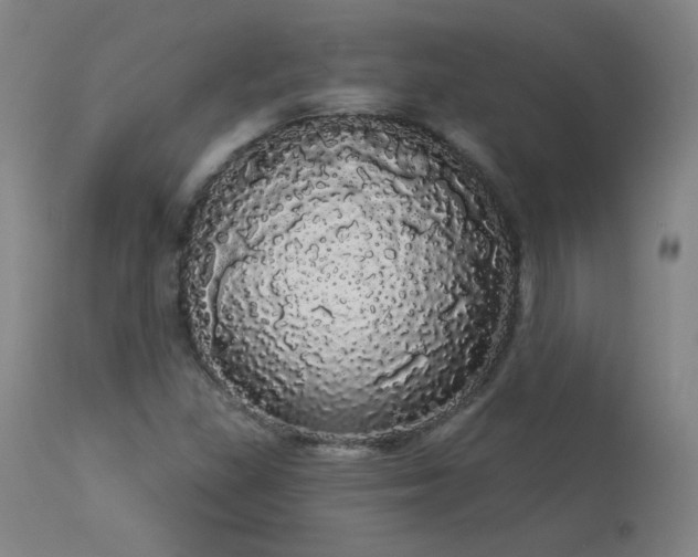 X0000113981309200910021127