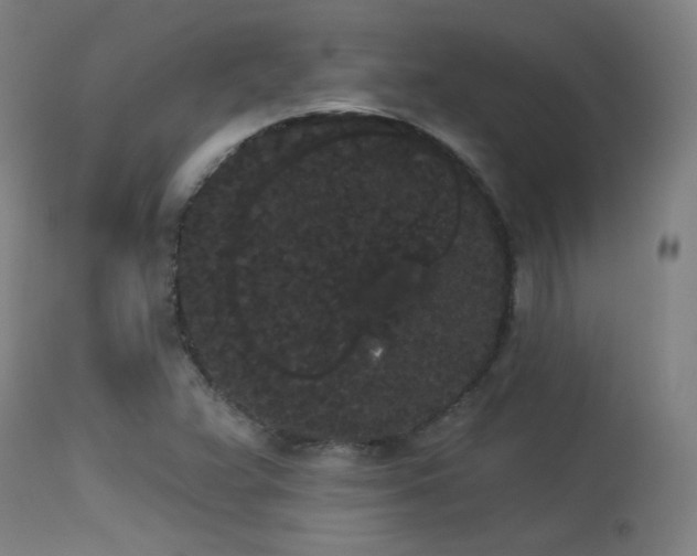 X0000113981359200910021126