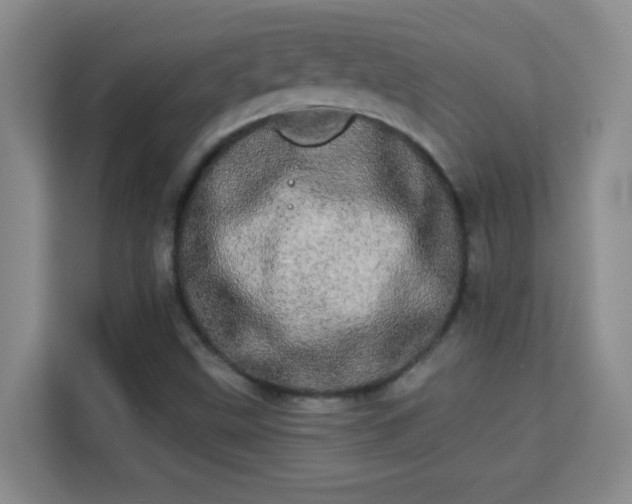 X0000113981499200910091307