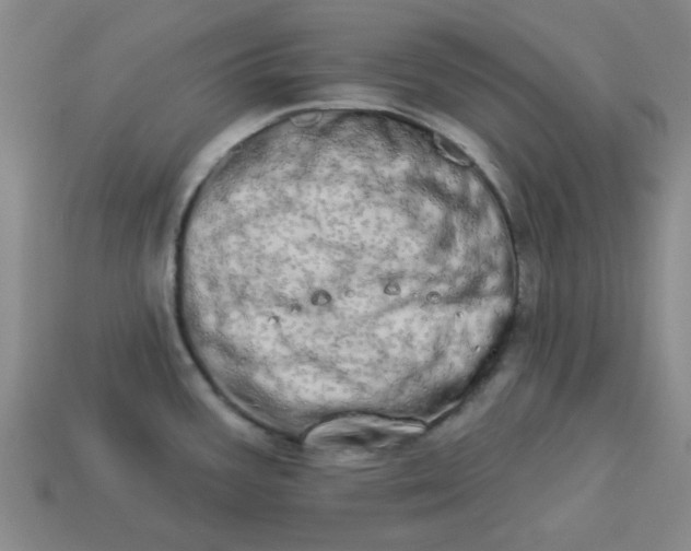 X0000113981387200910161612