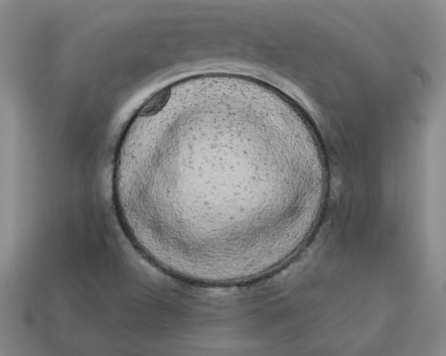 X0000113981504200910161610