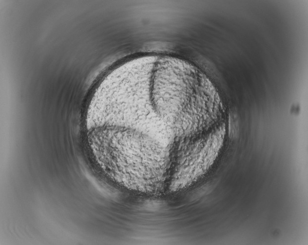 X0000113980204200910231715