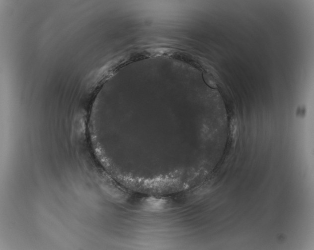 X0000113980570200910231711