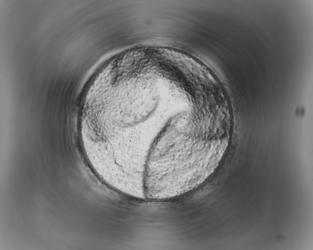 X0000113981000200910231704