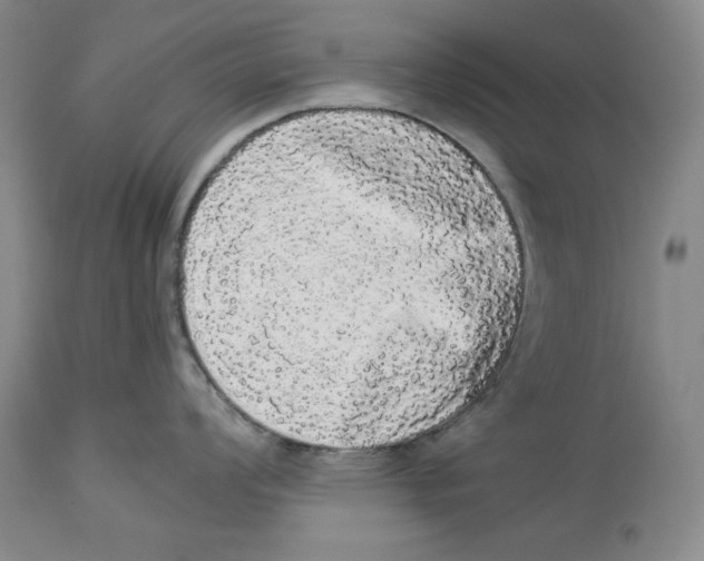 X0000113981008200910231704