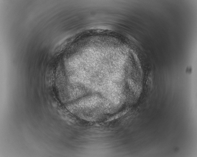 X0000113981014200910231703