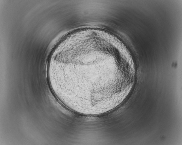 X0000113981180200910231701