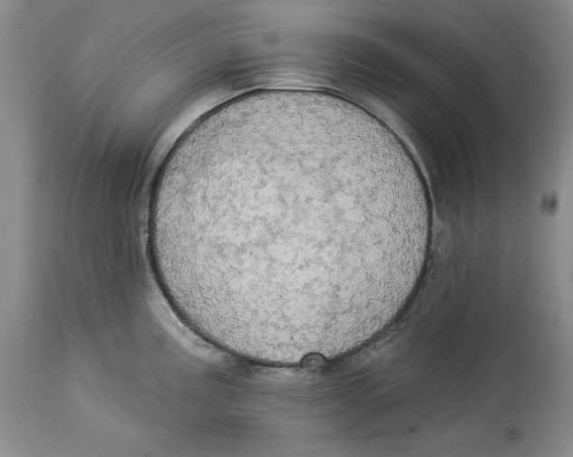 X0000113981195200910231701