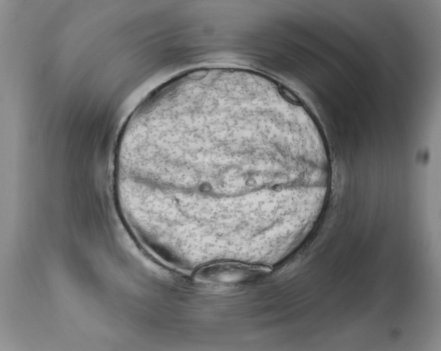 X0000113981387200910231658