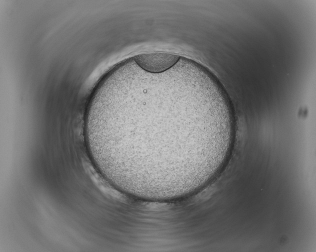 X0000113981499200910231656