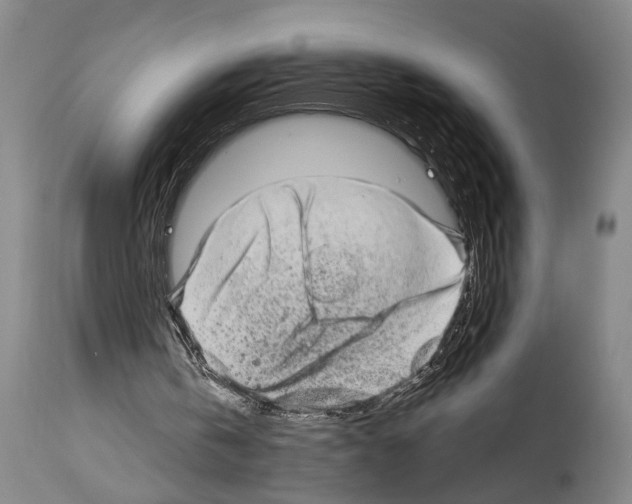 X0000113980146200911131103