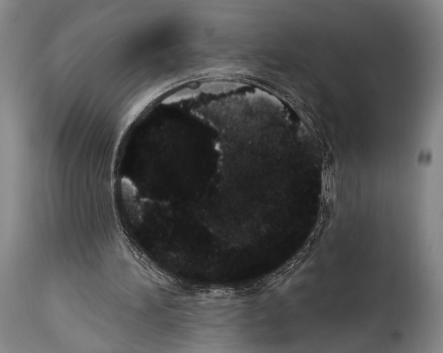X0000113980196200911131103