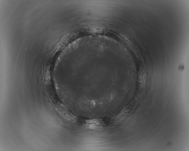 X0000113980516200911131058