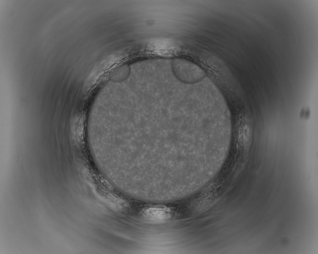 X0000113980595200911131057