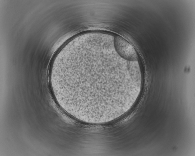 X0000113980885200911131053